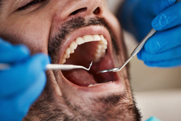 Best Emergency Orthodontic Repairs in Newhall, IA